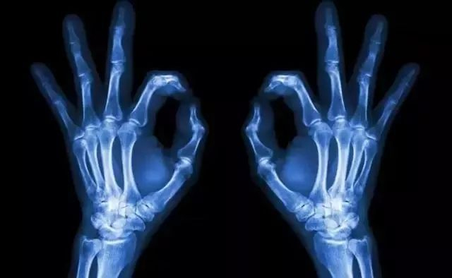 Scintillation Detectors for X Rays